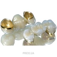 Фото Металлокерамическая коронка